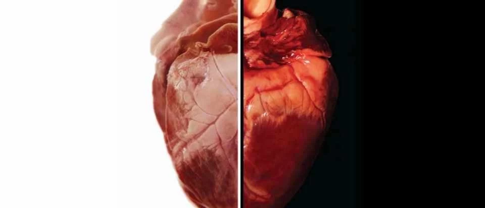 Προ των πυλών οι μεταμοσχεύσεις καρδιάς από χοίρους σε ανθρώπους;